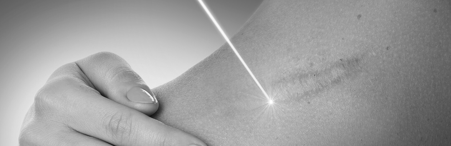 banner_laser-co2