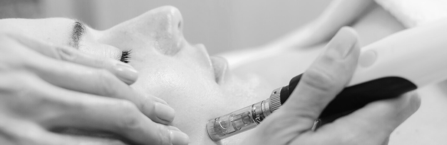 banner_microneedling-nb