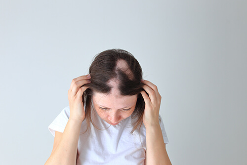 chute-cheveux
