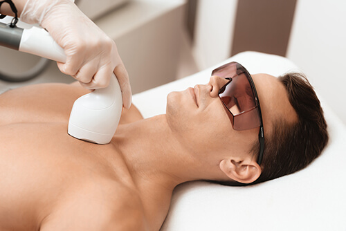 epilation-lui